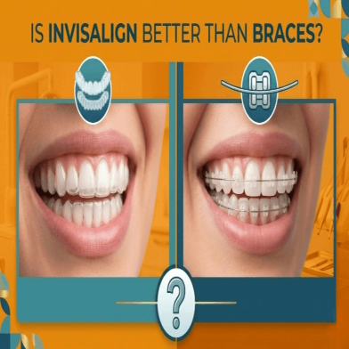 Is Invisalign Better Than Braces