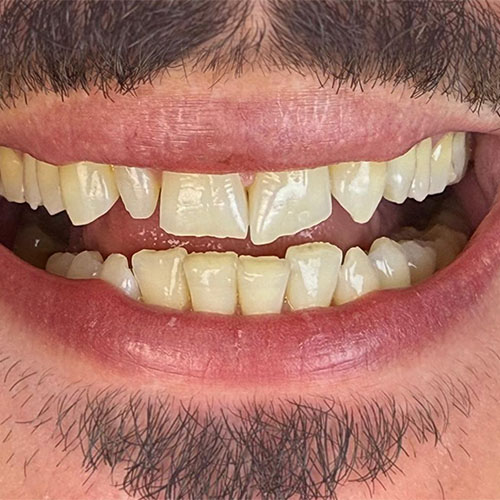Before.jpg