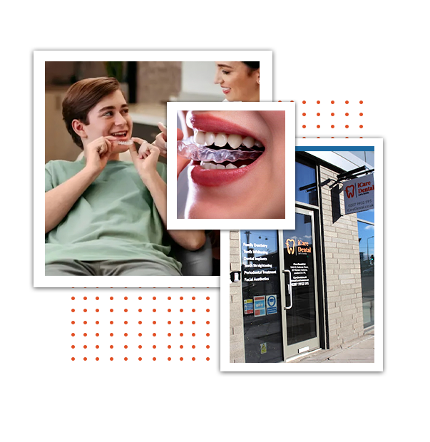 Invisalign at Lowest Price in London - iCare Dental - 2025