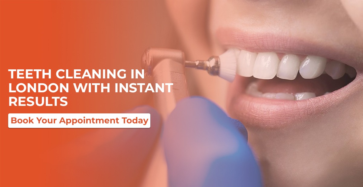 Teeth Cleaning in London with Instant Results – Book Now