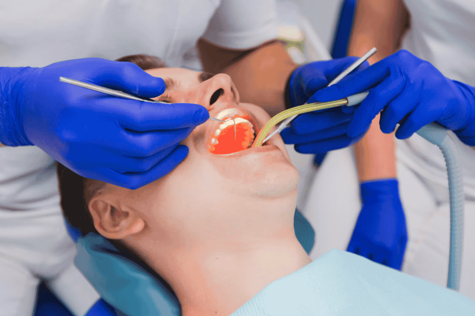 Composite Dental Filling